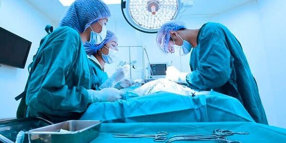 dzimumlocekļa paplašināšanas operācija